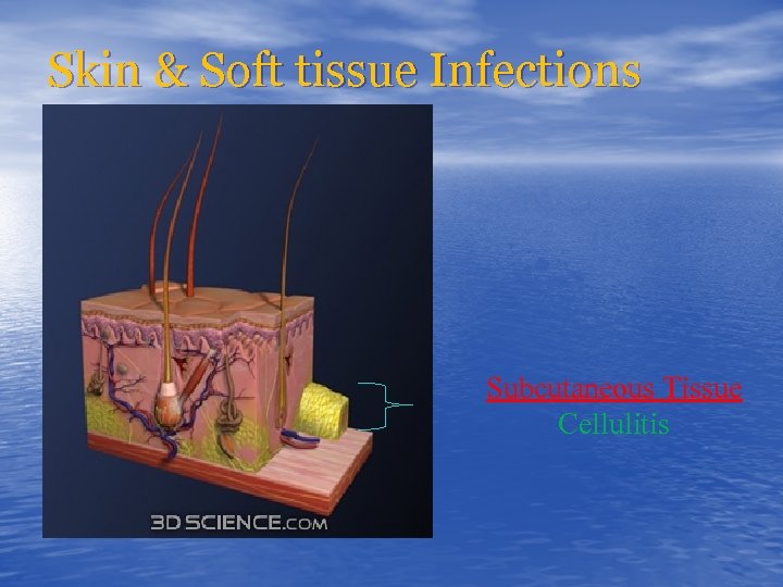 Skin & Soft tissue Infections Subcutaneous Tissue Cellulitis 