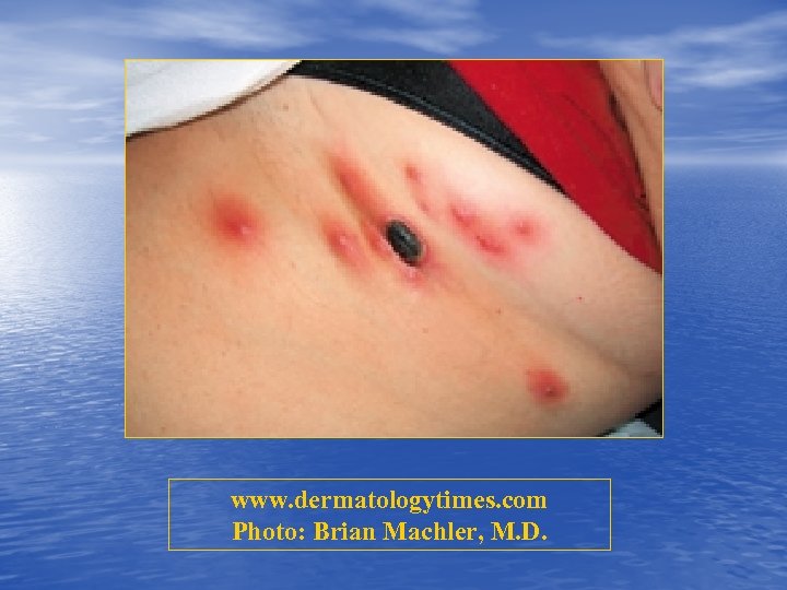 www. dermatologytimes. com Photo: Brian Machler, M. D. 