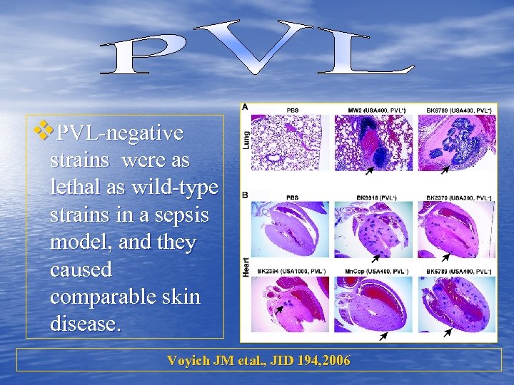 v. PVL-negative strains were as lethal as wild-type strains in a sepsis model, and