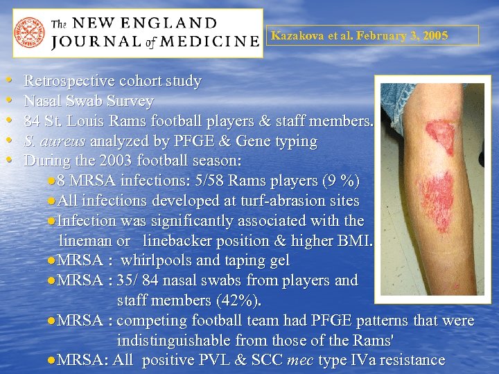Kazakova et al. February 3, 2005 • • • Retrospective cohort study Nasal Swab