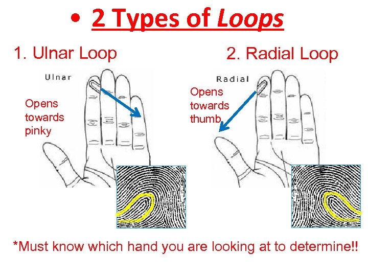  • 2 Types of Loops 1. Ulnar Loop Opens towards pinky 2. Radial