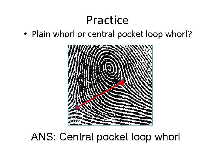 Practice • Plain whorl or central pocket loop whorl? ANS: Central pocket loop whorl