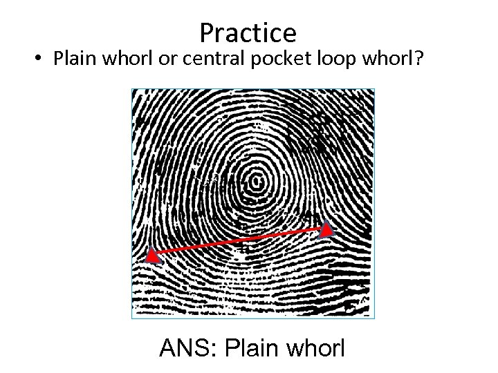 Practice • Plain whorl or central pocket loop whorl? ANS: Plain whorl 