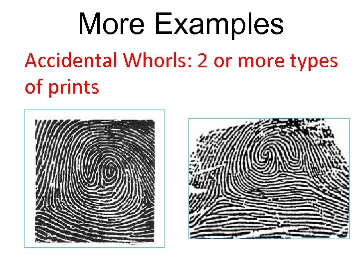 More Examples Accidental Whorls: 2 or more types of prints 