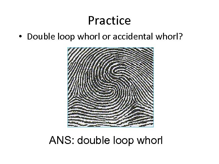 Practice • Double loop whorl or accidental whorl? ANS: double loop whorl 
