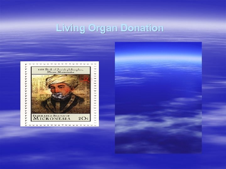 Living Organ Donation 