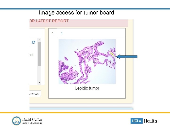 Image access for tumor board 
