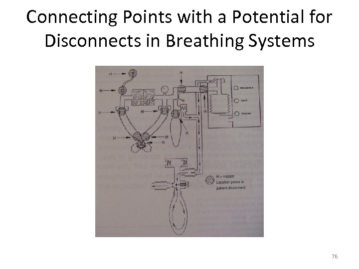 Connecting Points with a Potential for Disconnects in Breathing Systems 76 
