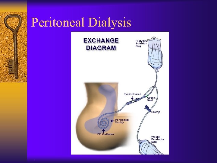 Peritoneal Dialysis . 