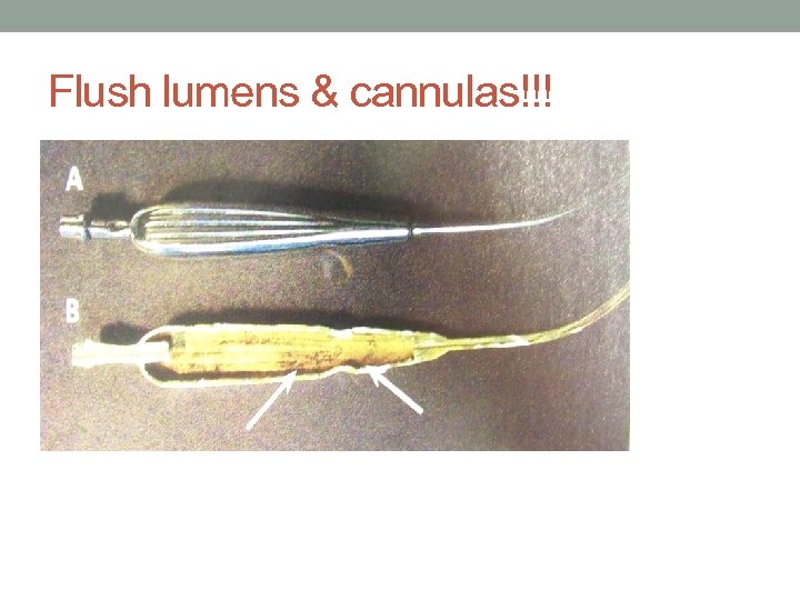 Flush lumens & cannulas!!! 