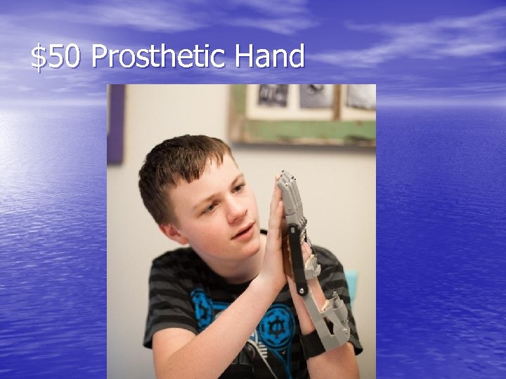 $50 Prosthetic Hand 
