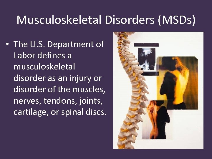 Musculoskeletal Disorders (MSDs) • The U. S. Department of Labor defines a musculoskeletal disorder