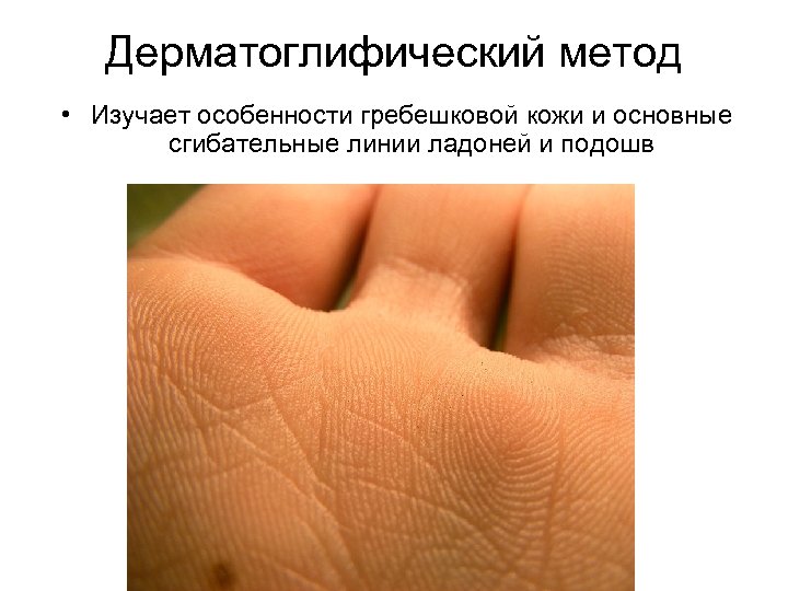 Дерматоглифический метод • Изучает особенности гребешковой кожи и основные сгибательные линии ладоней и подошв