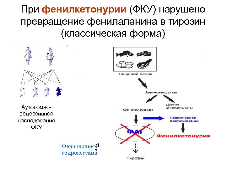 При фенилкетонурии (ФКУ) нарушено превращение фенилаланина в тирозин (классическая форма) Аутосомнорецессивное наследование ФКУ Фенилаланин