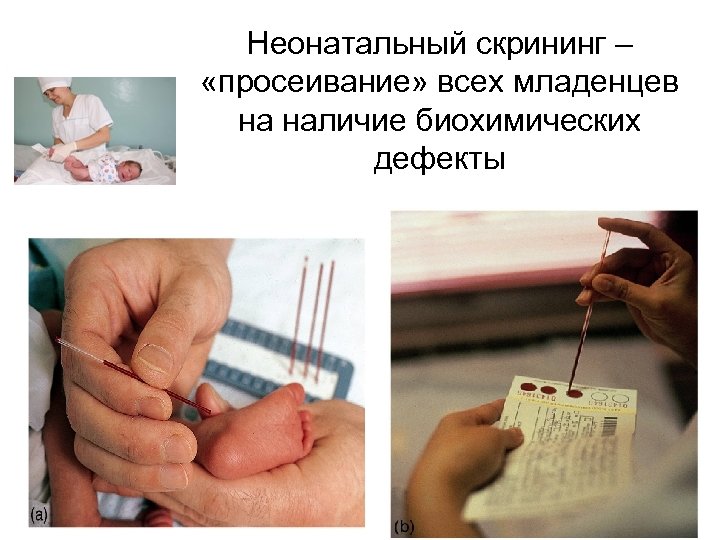 Неонатальный скрининг – «просеивание» всех младенцев на наличие биохимических дефекты 