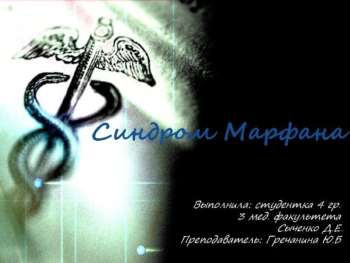 Синдром Марфана Выполнила: студентка 4 гр. 3 мед. факультета Сыченко Д. Е. Преподаватель: Гречанина