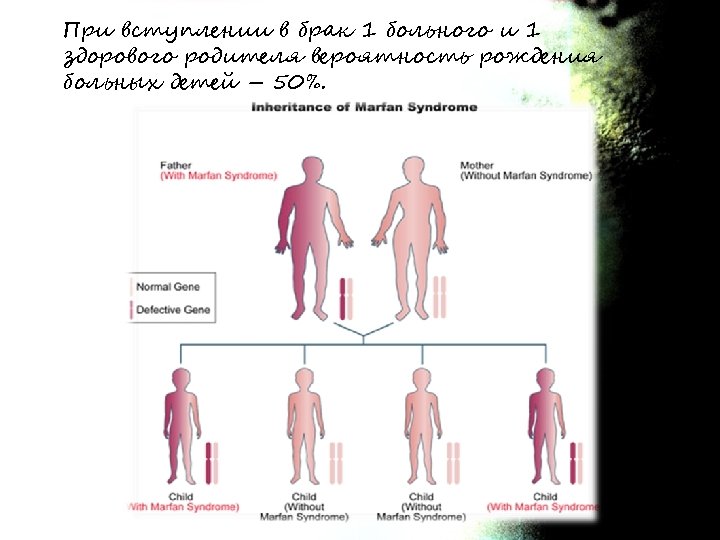 При вступлении в брак 1 больного и 1 здорового родителя вероятность рождения больных детей