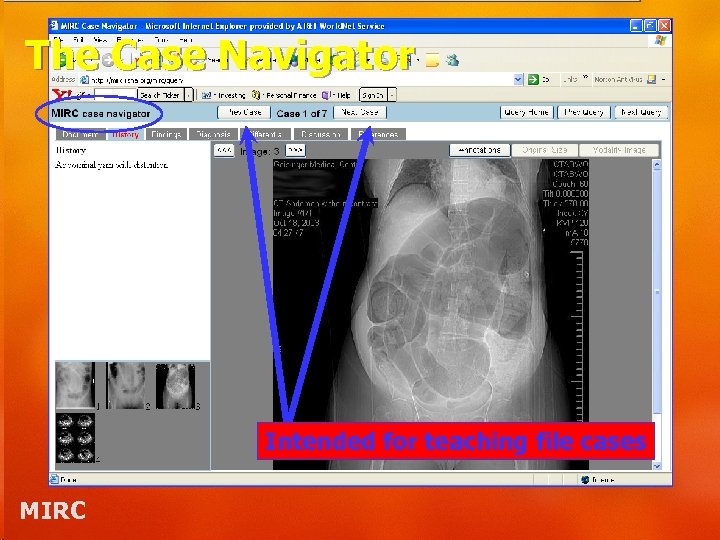 The Case Navigator Intended for teaching file cases MIRC 