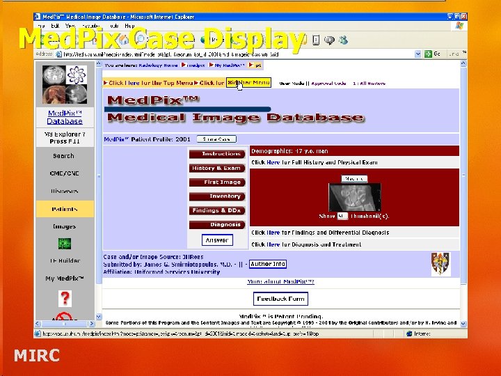 Med. Pix Case Display MIRC 