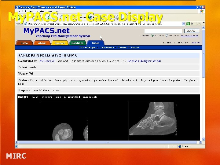 My. PACS. net Case Display MIRC 