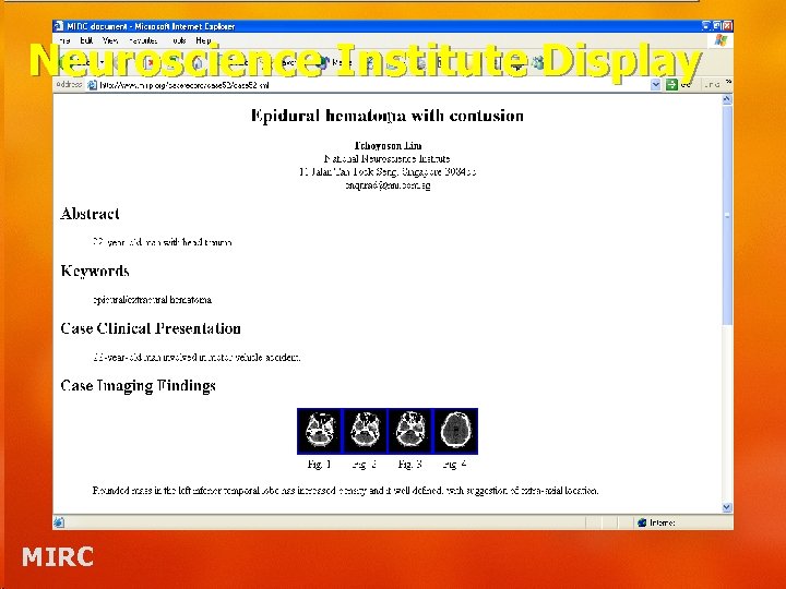 Neuroscience Institute Display MIRC 