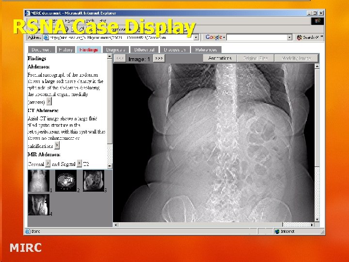 RSNA Case Display MIRC 