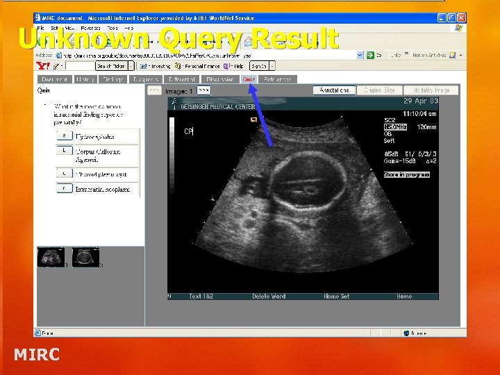 Unknown Query Result MIRC 