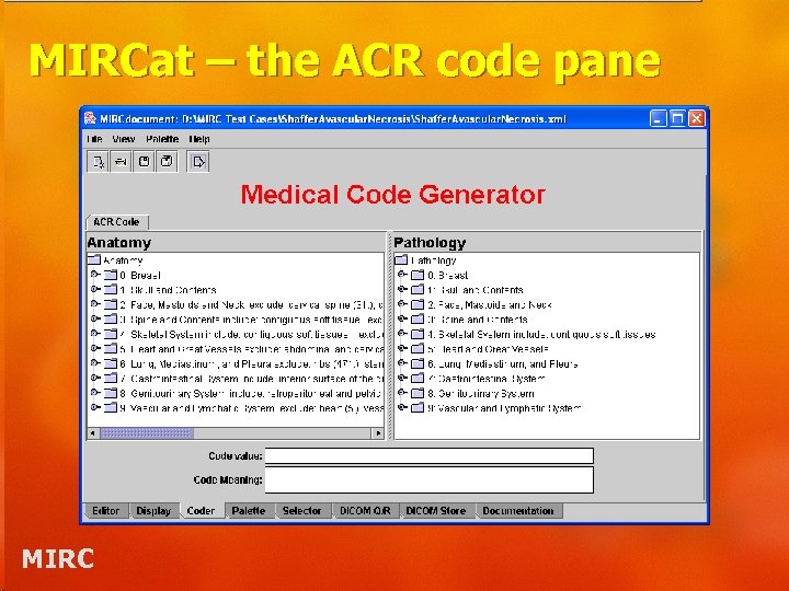 MIRCat – the ACR code pane MIRC 