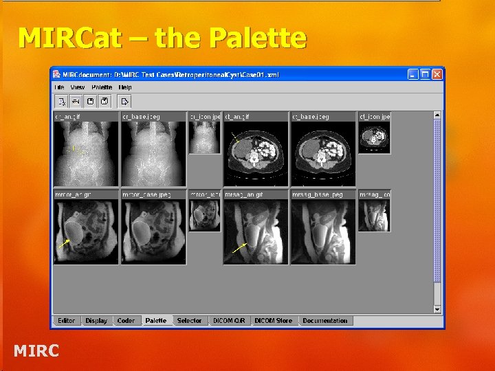 MIRCat – the Palette MIRC 