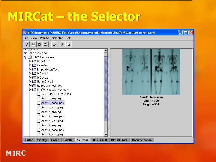 MIRCat – the Selector MIRC 