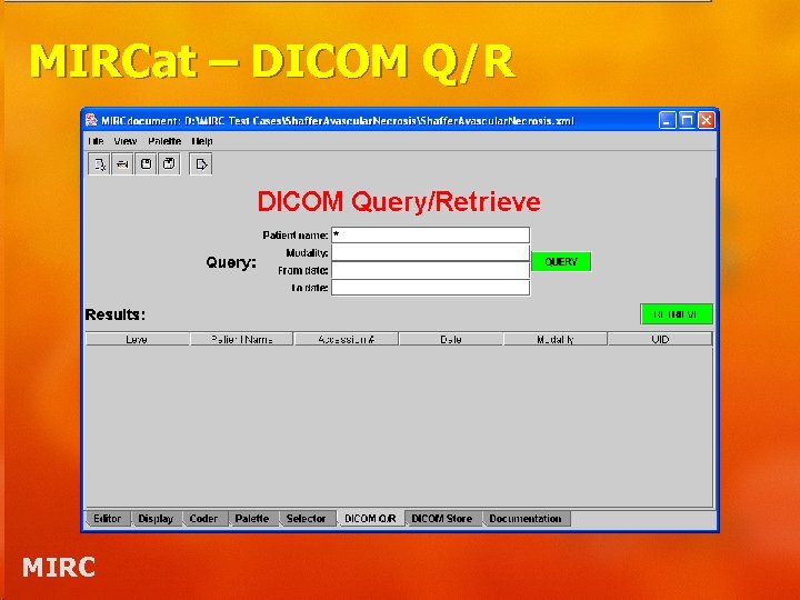 MIRCat – DICOM Q/R MIRC 