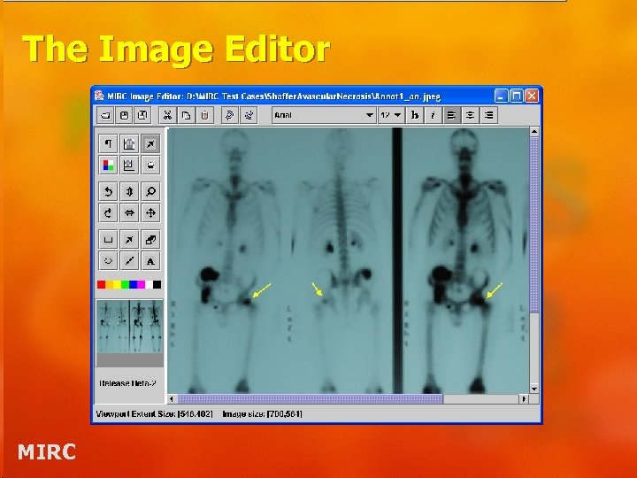 The Image Editor MIRC 