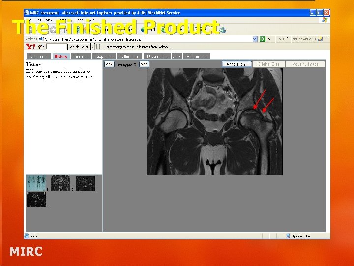 The Finished Product MIRC 