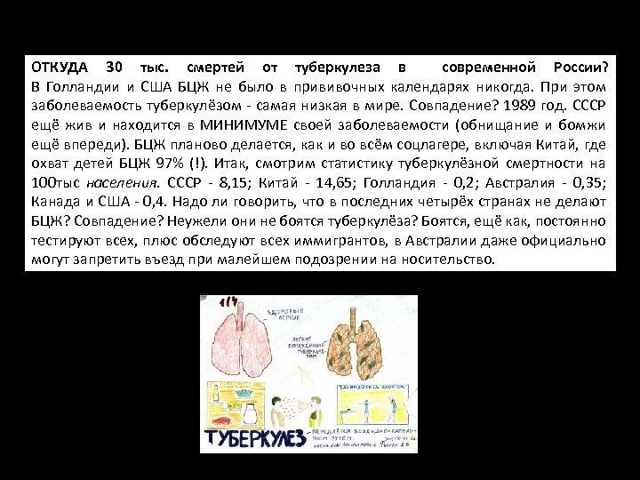 ОТКУДА 30 тыс. смертей от туберкулеза в современной России? В Голландии и США БЦЖ