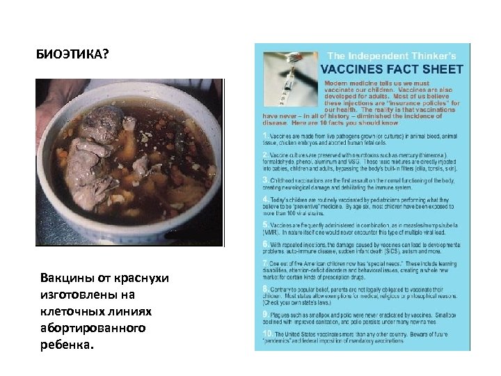 БИОЭТИКА? Вакцины от краснухи изготовлены на клеточных линиях абортированного ребенка. 