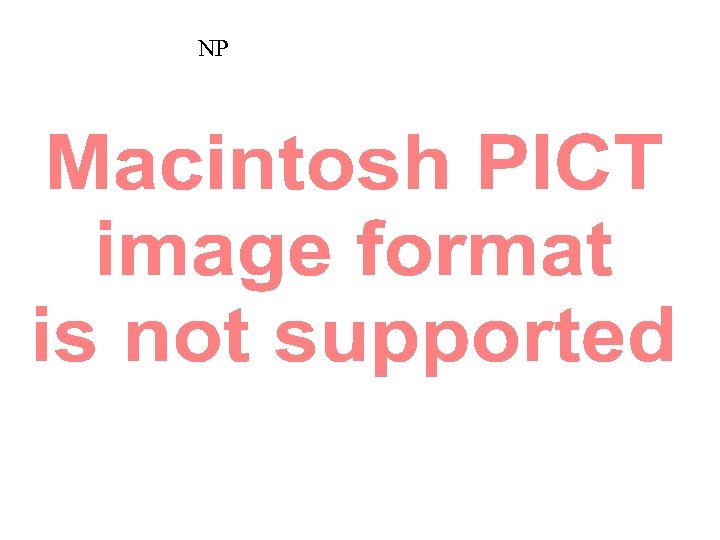 NP 