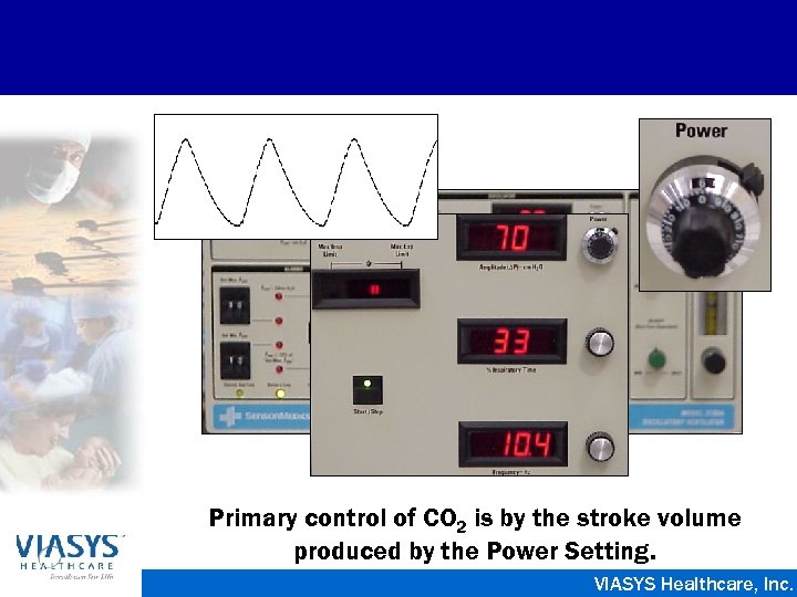 Primary control of CO 2 is by the stroke volume produced by the Power