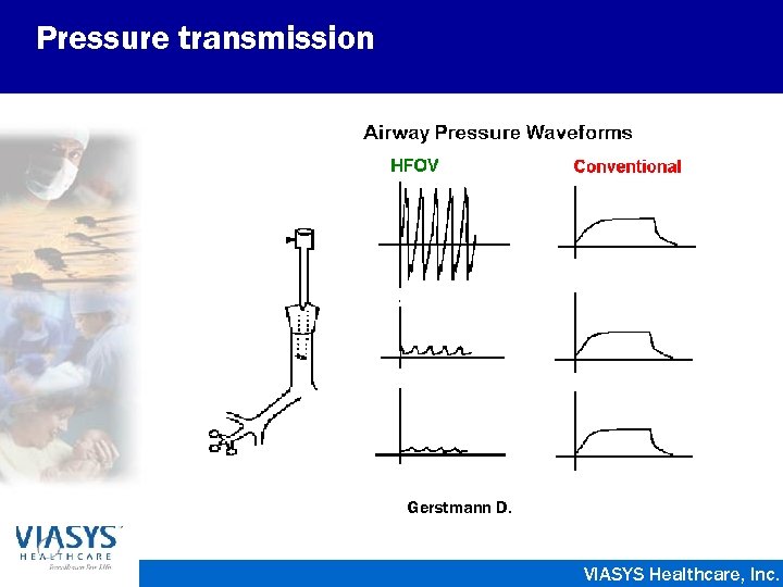 Pressure transmission Gerstmann D. VIASYS Healthcare, Inc. 