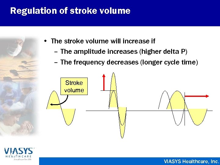 Regulation of stroke volume • The stroke volume will increase if – The amplitude