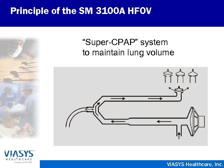 Principle of the SM 3100 A HFOV “Super-CPAP” system to maintain lung volume VIASYS