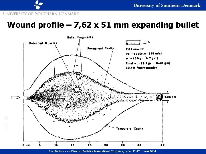 Wound profile – 7, 62 x 51 mm expanding bullet First Ballistics and Wound