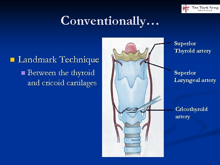 Conventionally… n Landmark Technique n Between the thyroid and cricoid cartilages Superior Thyroid artery