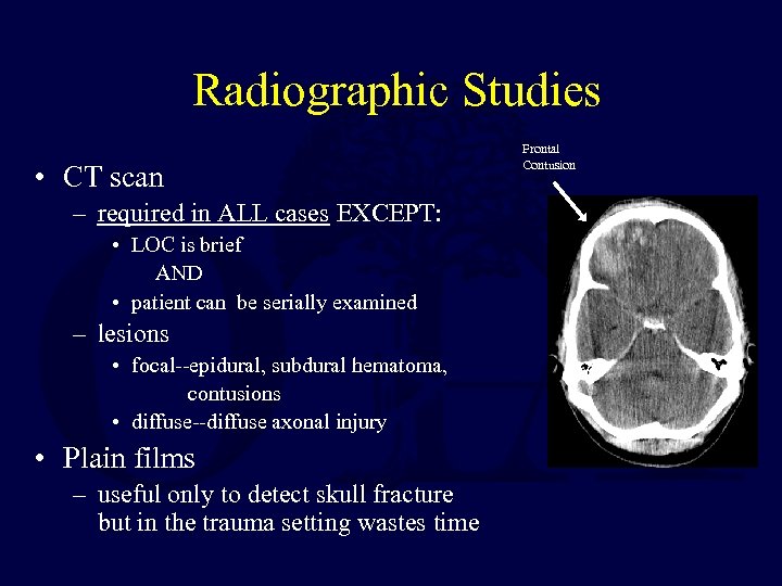 Radiographic Studies • CT scan Frontal Contusion – required in ALL cases EXCEPT: •