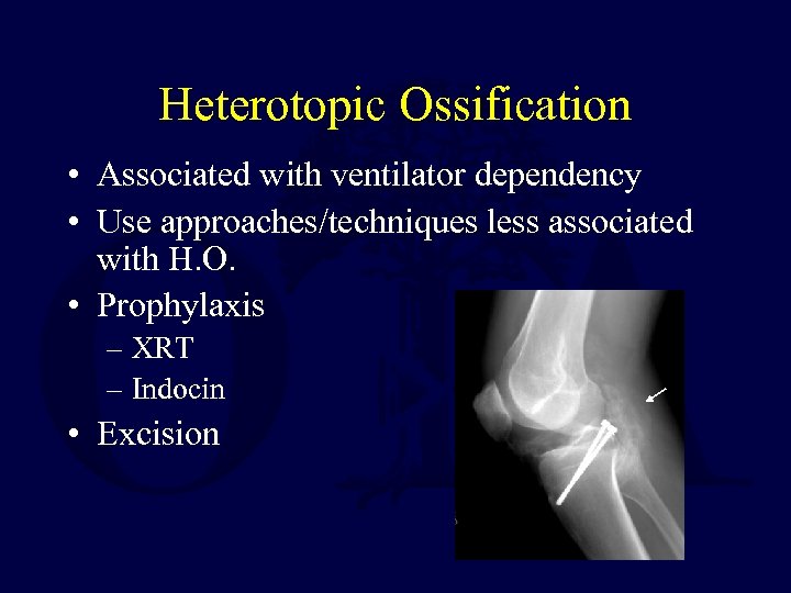 Heterotopic Ossification • Associated with ventilator dependency • Use approaches/techniques less associated with H.