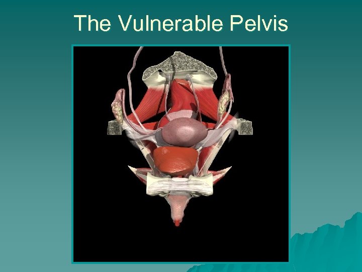 The Vulnerable Pelvis 