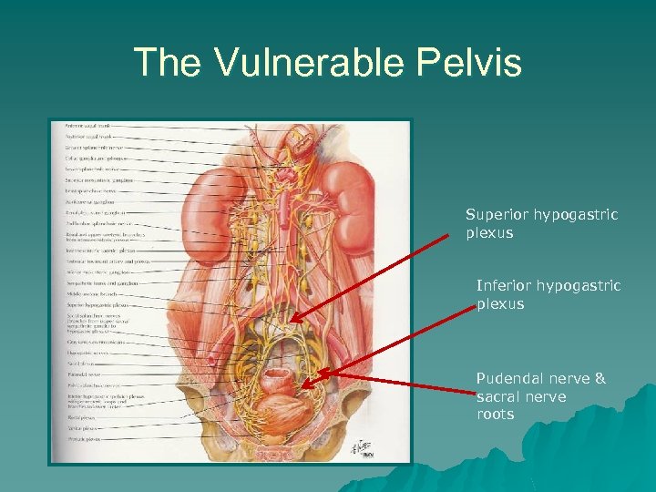 The Vulnerable Pelvis Superior hypogastric plexus Inferior hypogastric plexus Pudendal nerve & sacral nerve