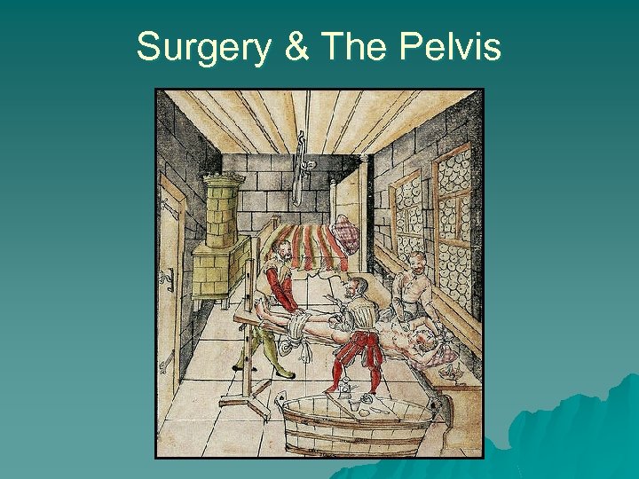 Surgery & The Pelvis 