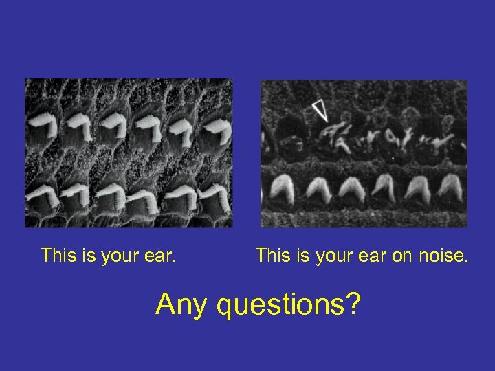 This is your ear. This is your ear on noise. Any questions? 