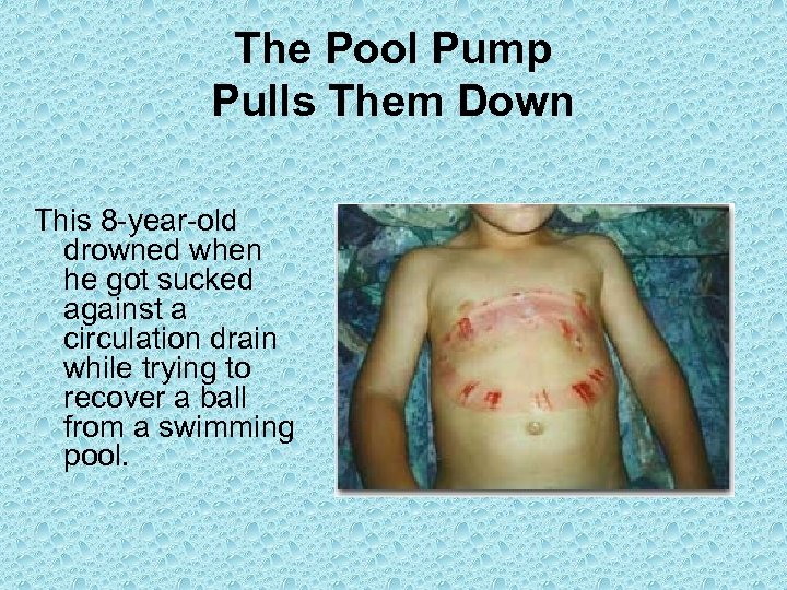 The Pool Pump Pulls Them Down This 8 -year-old drowned when he got sucked