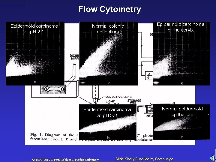 Flow Cytometry Epidermoid carcinoma at p. H 2. 1 Normal colonic epithelium Epidermoid carcinoma